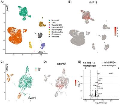 Histamine and Th2 cytokines independently and synergistically upregulate MMP12 expression in human M2 macrophages